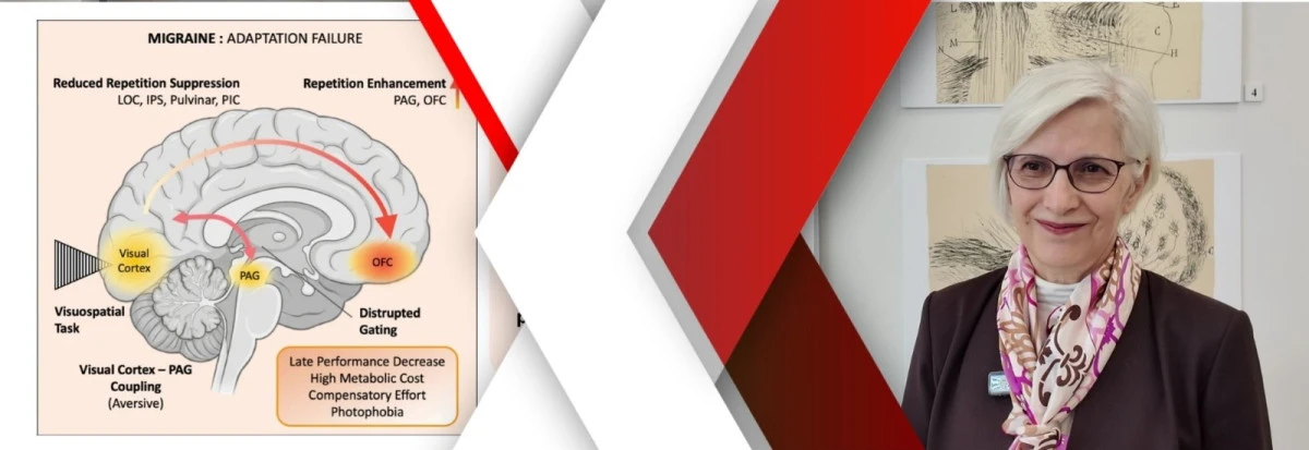 Işık ve desenler  Migreni tetikliyor